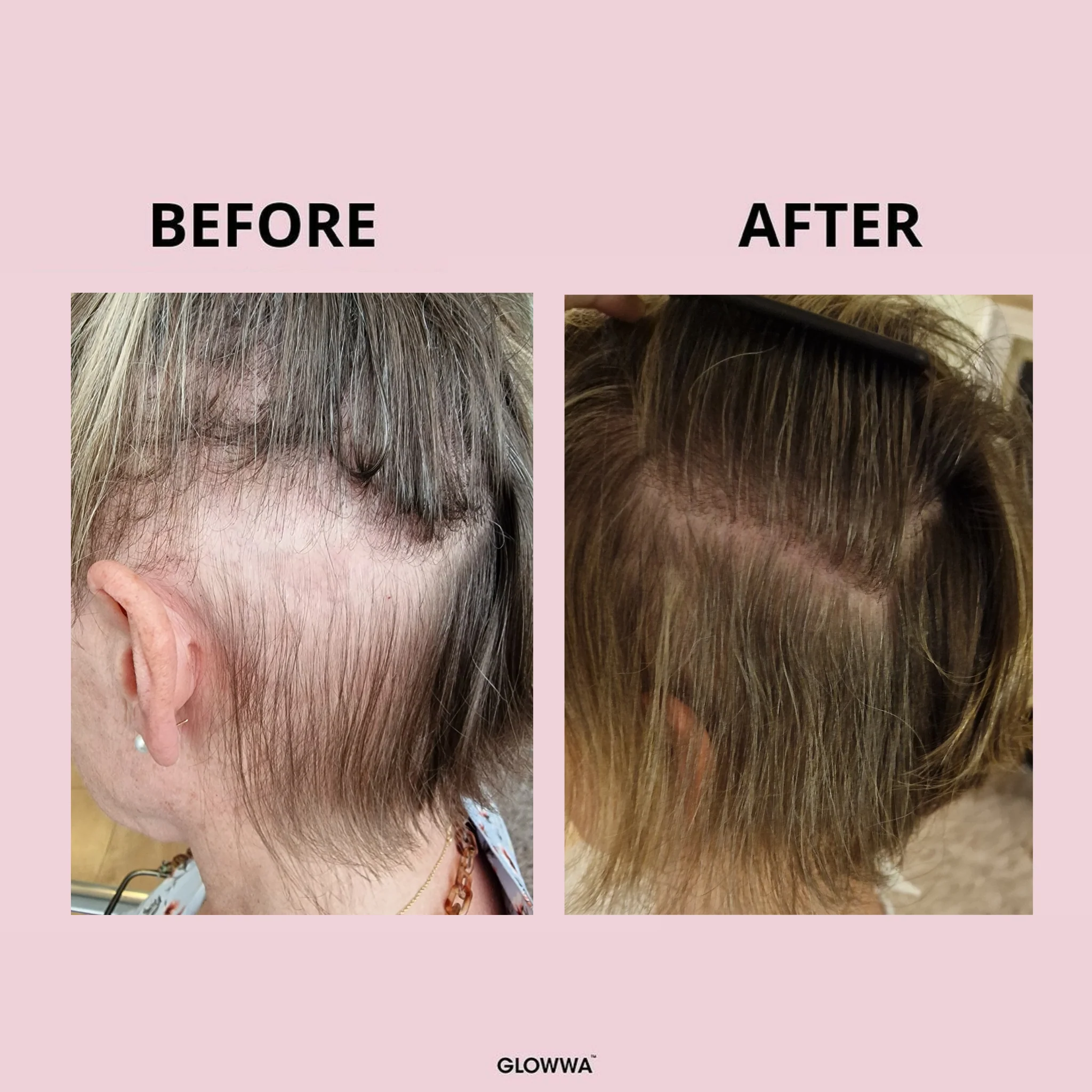 HAIR FOOD - Hair Vitamins, 1 Month Supply - Image 8
