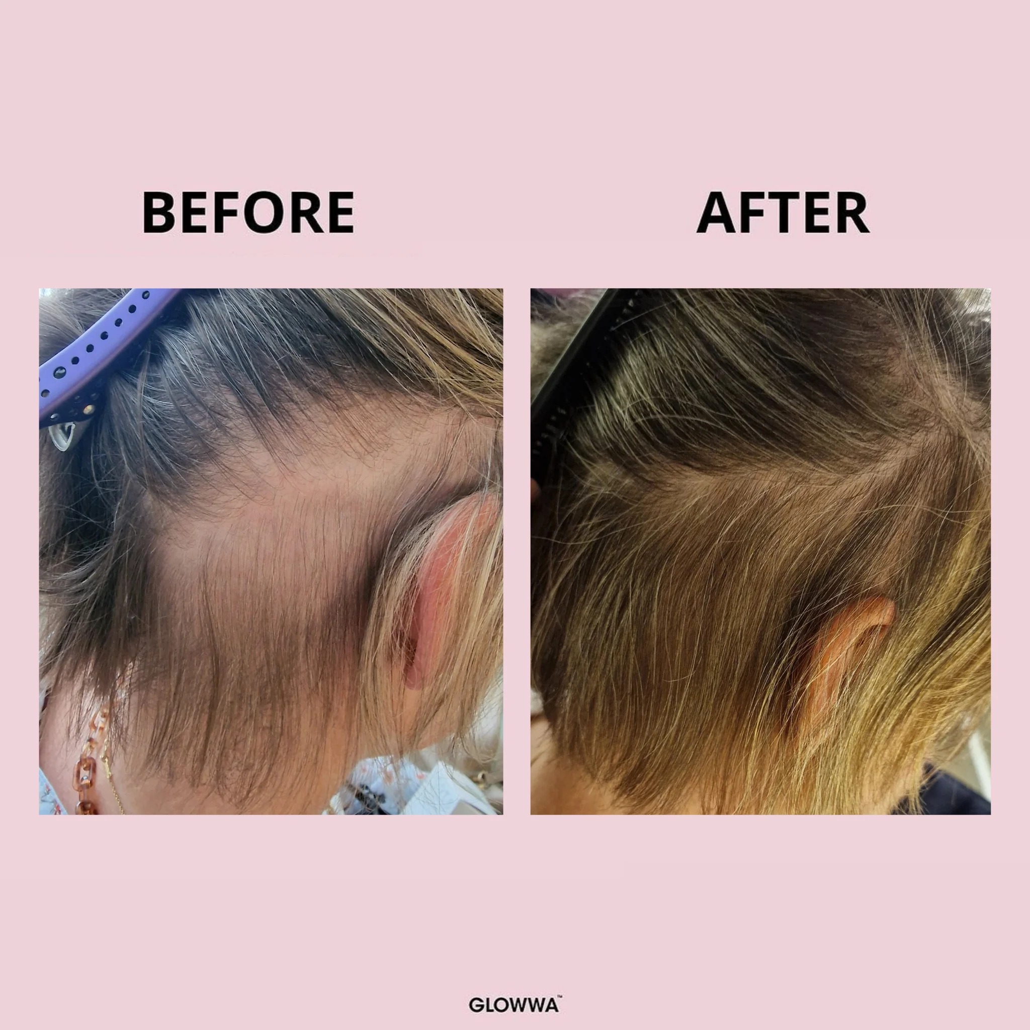HAIR FOOD - 6 MONTH SUPPLY - Image 10