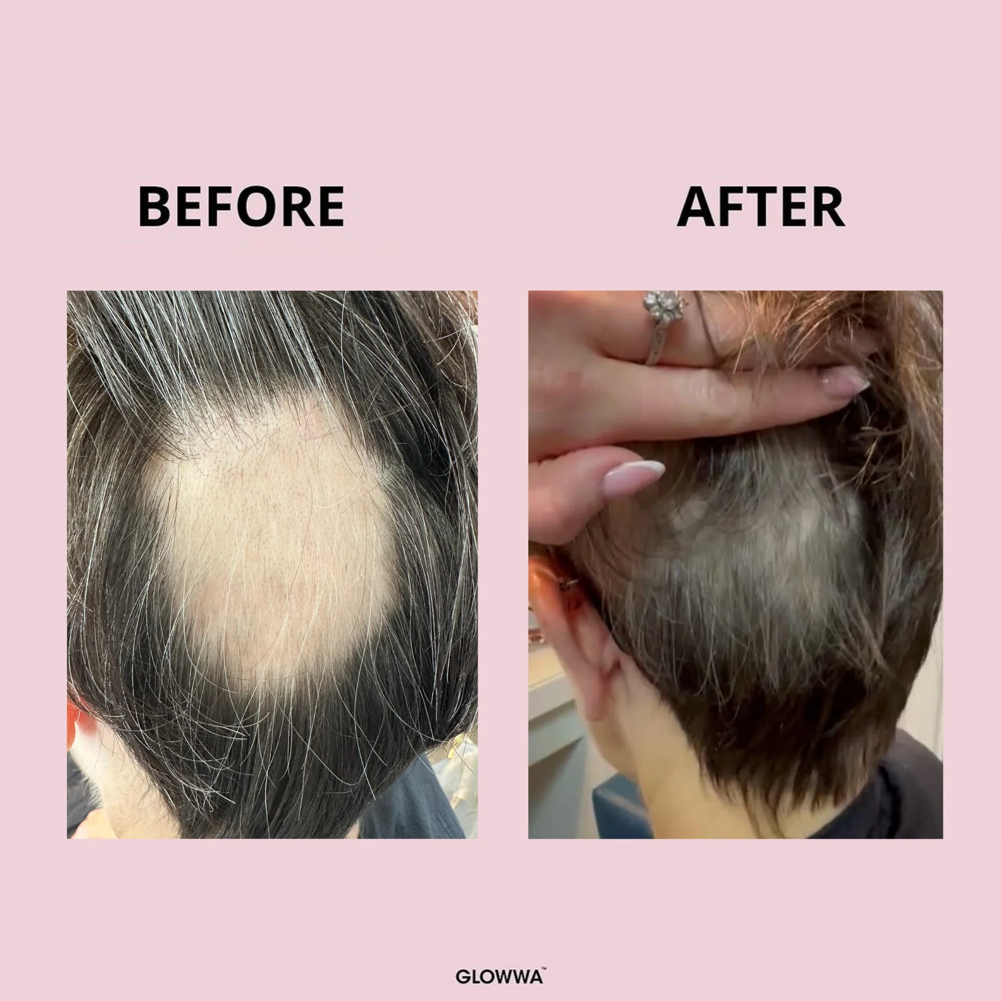 HAIR FOOD - 6 MONTH SUPPLY - Image 12