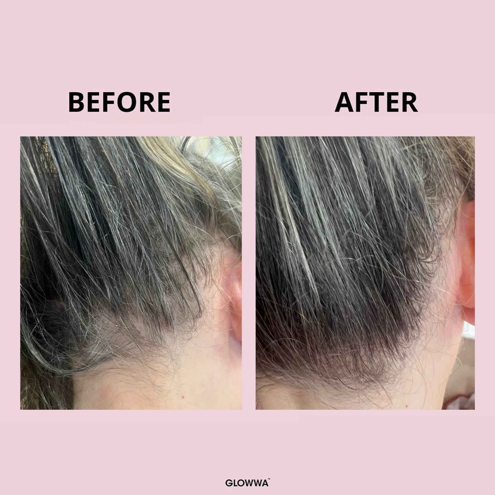 HAIR FOOD - 6 MONTH SUPPLY - Image 8