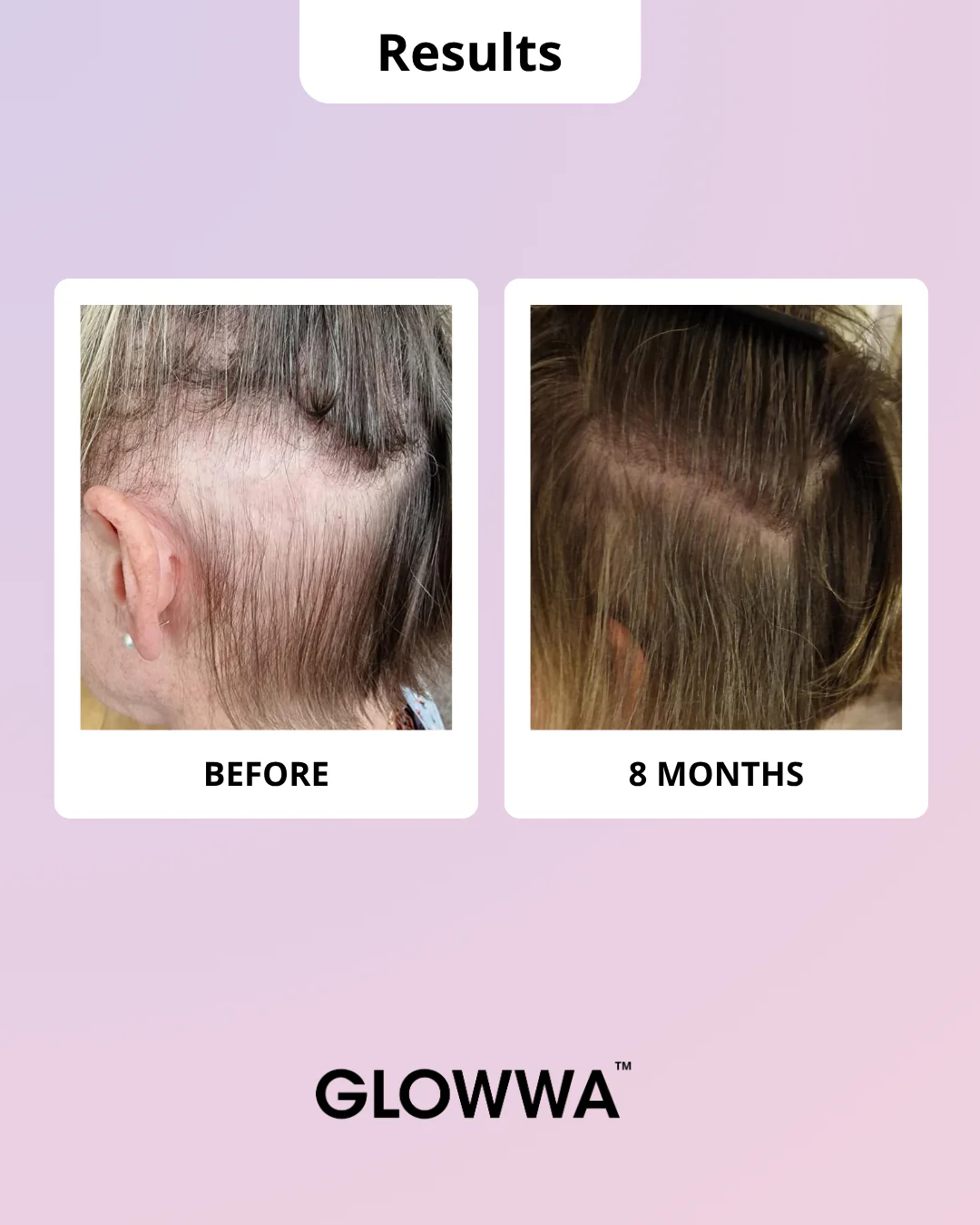 HAIR FOOD | MENO - 1 Month Supply - Image 5