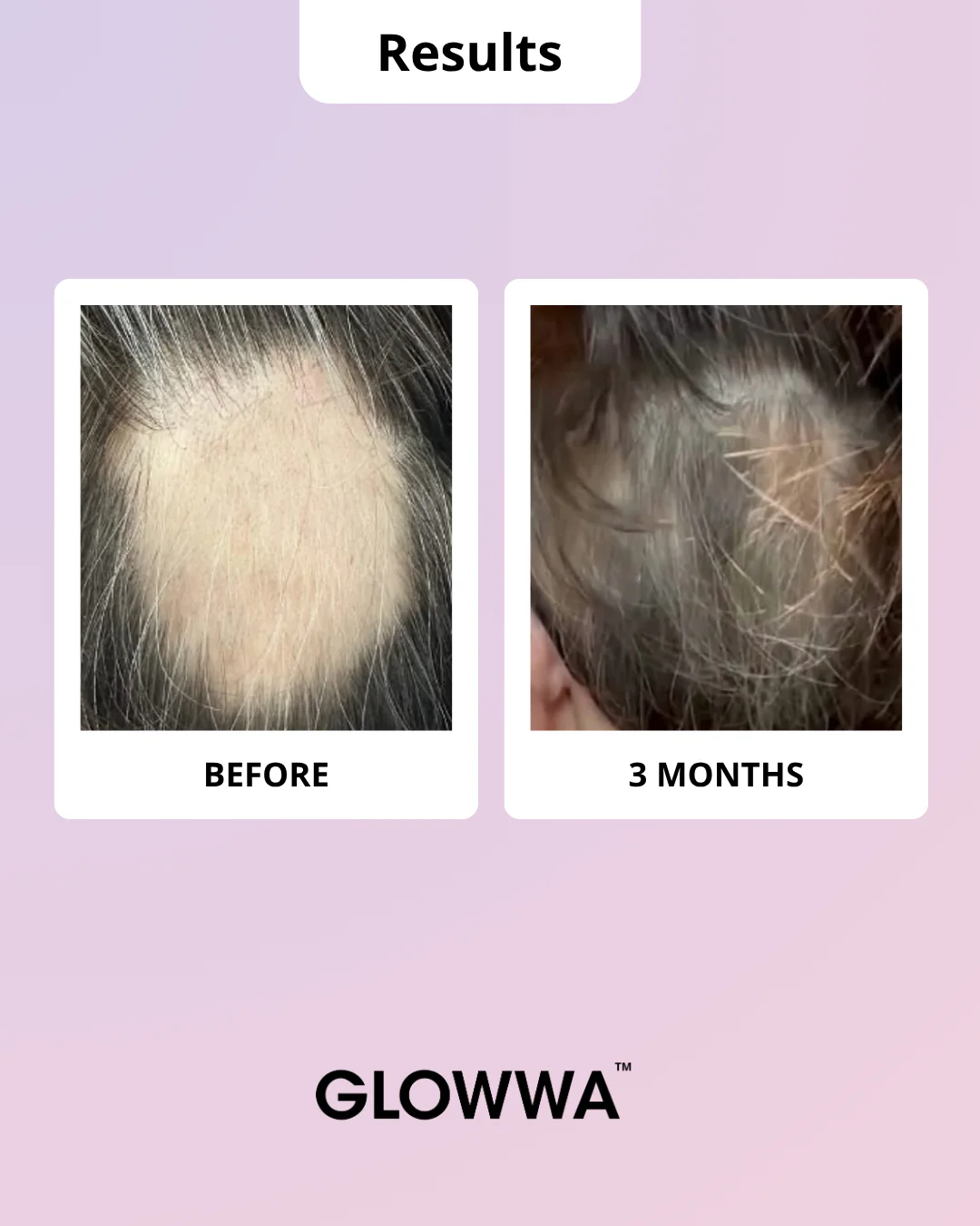 HAIR FOOD | MENO - 1 Month Supply - Image 6