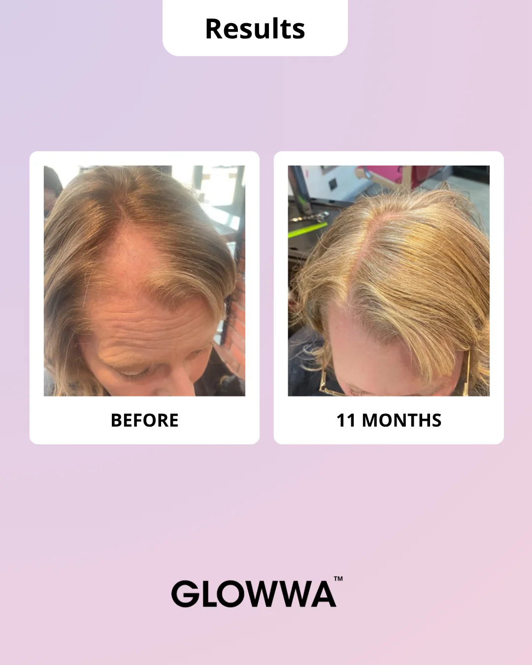 HAIR FOOD | MENO - 1 Month Supply - Image 4